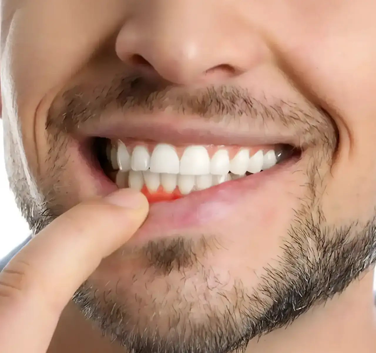Parodontologia cura - Studio Dentistico a Olbia - Rehabilita - Dott.ri Farre e Tilli