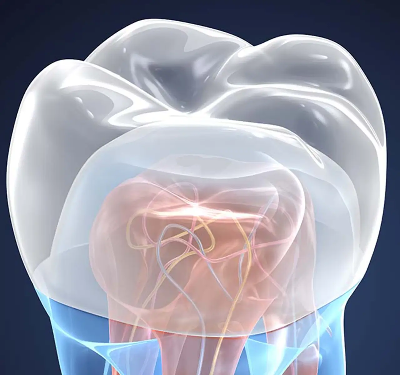 Terapia per la cura della carie e il ripristino dell’integrità dentale - Studio Dentistico a Olbia - Rehabilita - Dott.ri Farre e Tilli