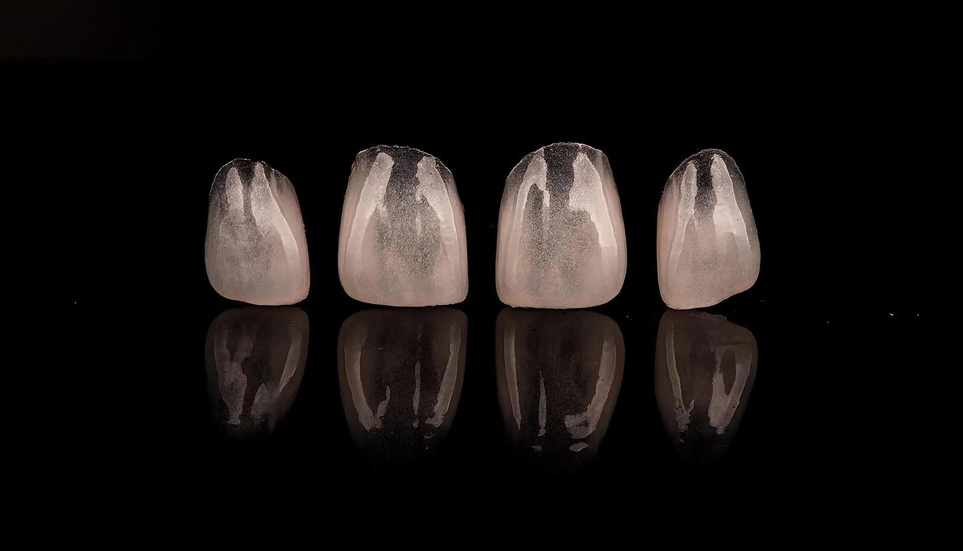 Faccette Dentali - Studio Dentistico a Olbia - Rehabilita - Dott.ri Farre e Tilli
