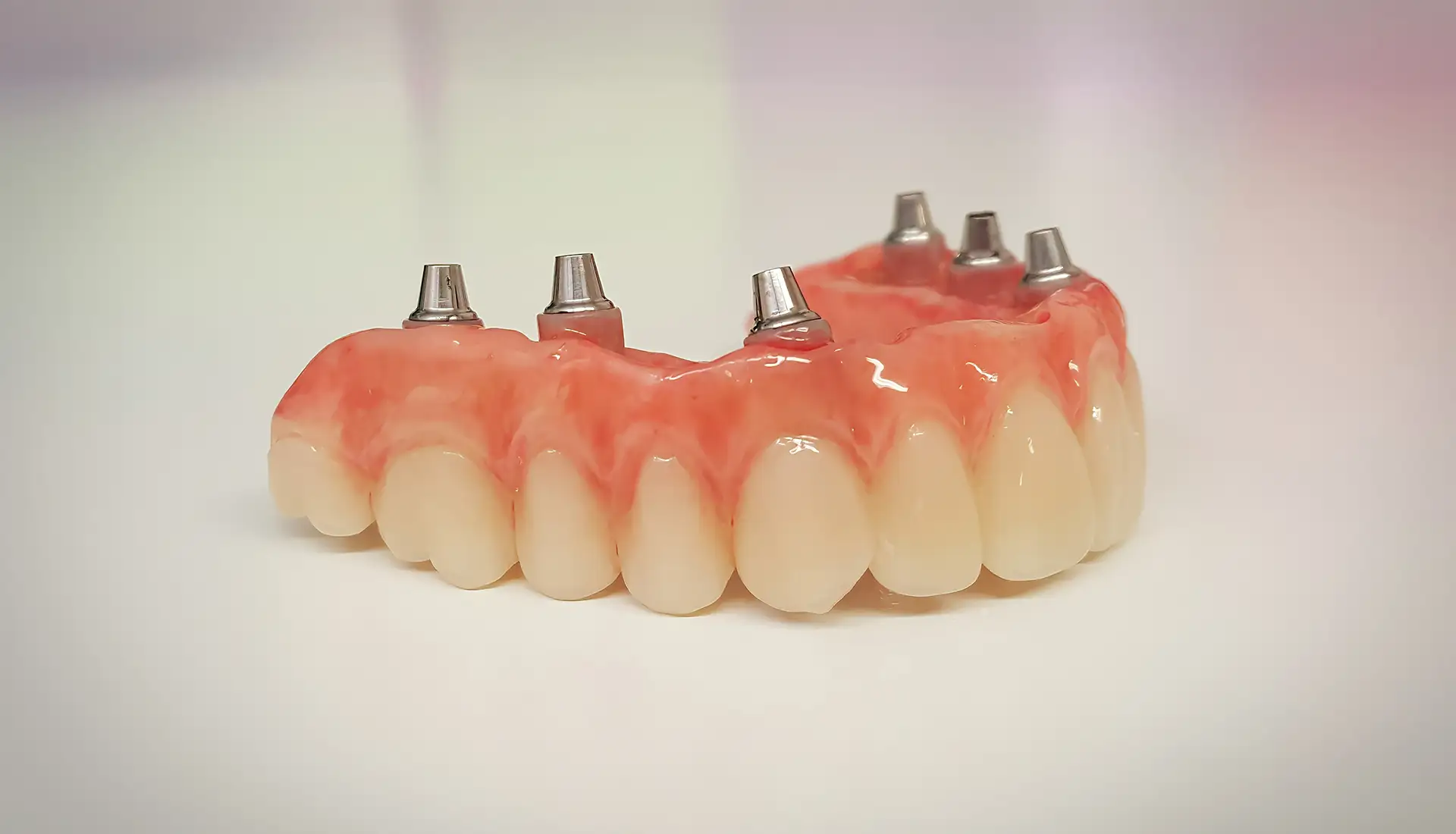Protesi Dentali - Trattamenti - Studio Dentistico a Olbia - Rehabilita - Dott.ri Farre e Tilli
