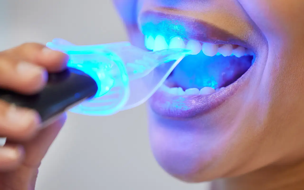 Migliorare la bellezza del tuo sorriso - Studio Dentistico a Olbia - Rehabilita - Dott.ri Farre e Tilli