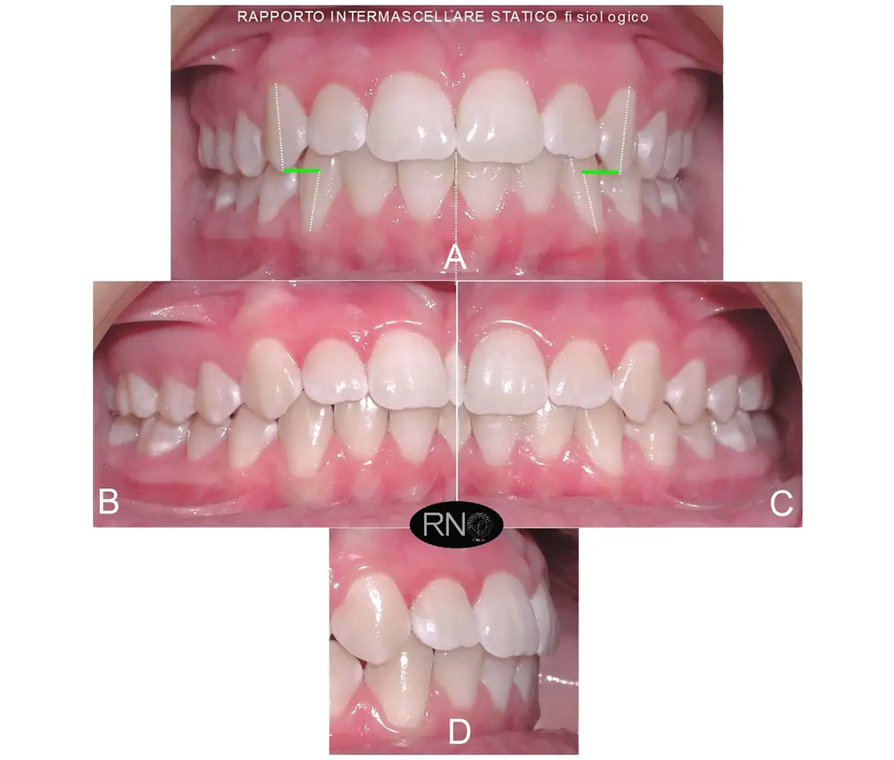 R.N.O. al servizio del paziente - Studio Dentistico a Olbia - Rehabilita - Dott.ri Farre e Tilli R.N.O. al servizio del paziente - Studio Dentistico a Olbia - Rehabilita - Dott.ri Farre e Tilli