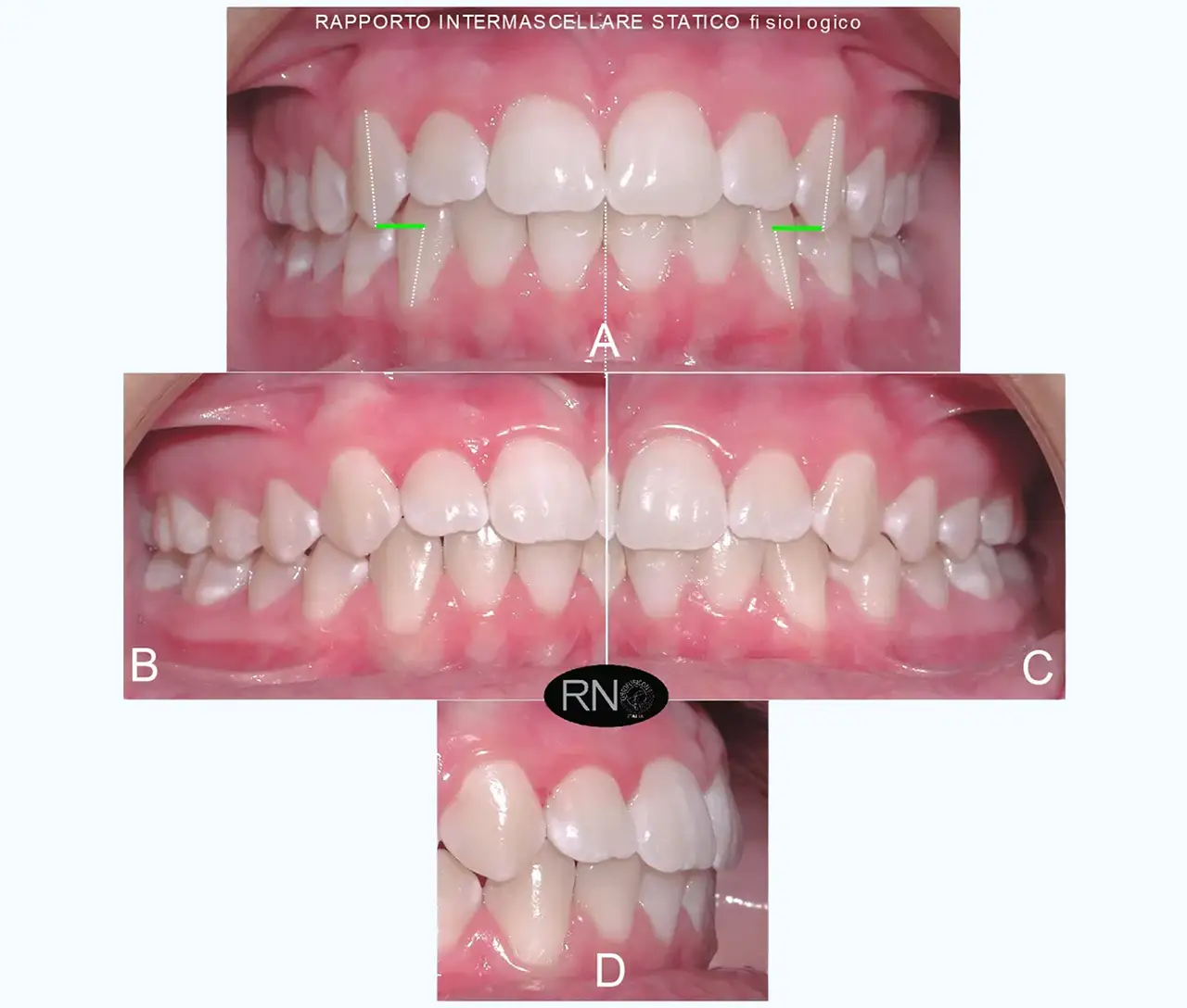 R.N.O. al servizio del paziente - Studio Dentistico a Olbia - Rehabilita - Dott.ri Farre e Tilli
